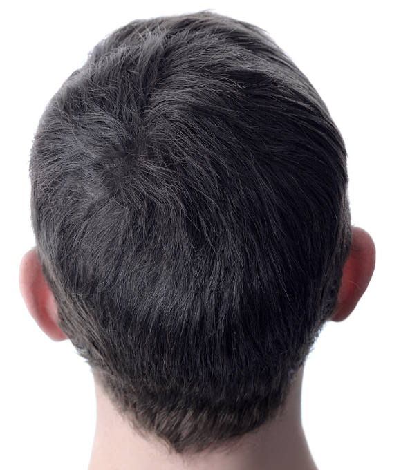 Before image