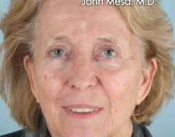 Dr. John Mesa, MD.