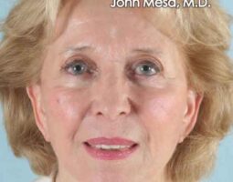 Dr. John Mesa, MD.