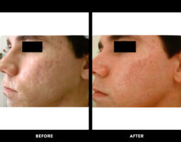 Rowe Plastic Surgery