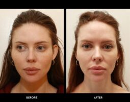 Rowe Plastic Surgery
