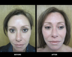 Rowe Plastic Surgery