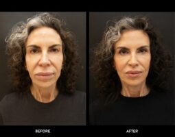 Rowe Plastic Surgery