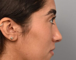 Pearlman Aesthetic Surgery