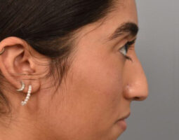 Pearlman Aesthetic Surgery
