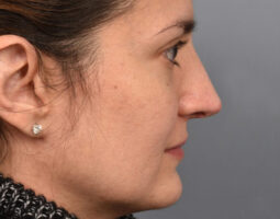 Pearlman Aesthetic Surgery