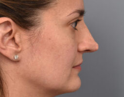 Pearlman Aesthetic Surgery