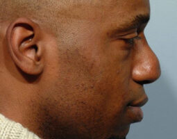 Pearlman Aesthetic Surgery