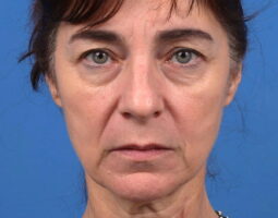 Renata Khelemsky, MD