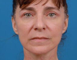 Renata Khelemsky, MD