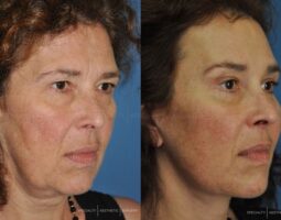 Dr. Grigoriy Mashkevich, MD