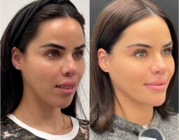 Hanna Face and Jaw
