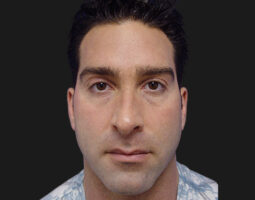 Dr. Kevin Tehrani, MD, FACS