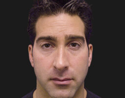 Dr. Kevin Tehrani, MD, FACS
