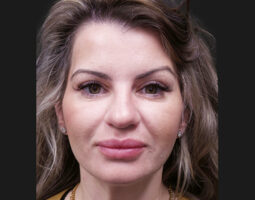 Dr. Kevin Tehrani, MD, FACS