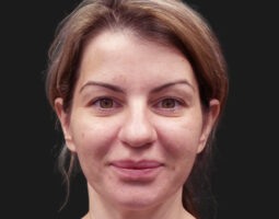 Dr. Kevin Tehrani, MD, FACS