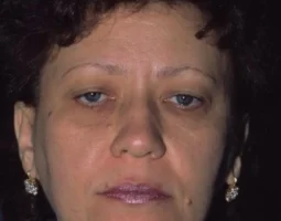 Leonard Grossman MD Plastic Surgeon