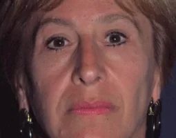 Leonard Grossman MD Plastic Surgeon