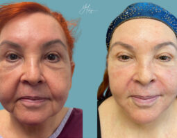 Evolve Plastic Surgery