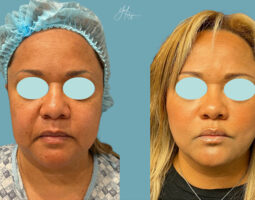 Evolve Plastic Surgery