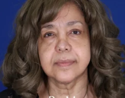 Dr. Bianca J. Molina, MD