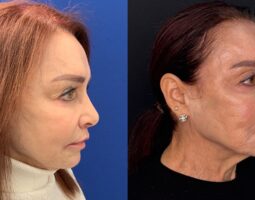 Ulysses Scarpidis, MD