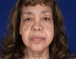 Dr. Bianca J. Molina, MD