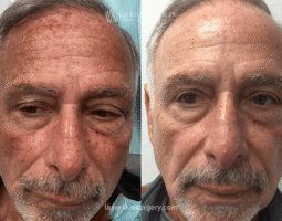 Dr. Lloyd Hoffman
