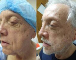 Dr. Luis A. Cenedese, MD