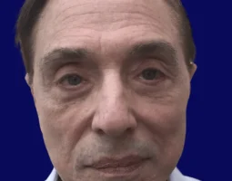 Robert Tornambe, MD
