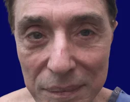 Robert Tornambe, MD