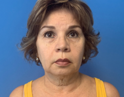Pincus Plastic Surgery
