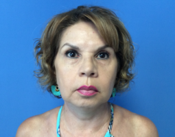 Pincus Plastic Surgery