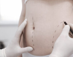 Dr. Sophie Bartsich, MD FACS