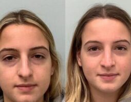 Affordable Plastic Surgery