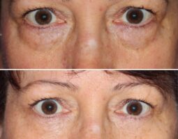 Dara Liotta, MD, FACS