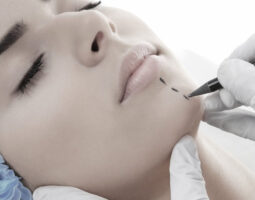 Dr. Sophie Bartsich, MD FACS