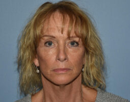 Pincus Plastic Surgery