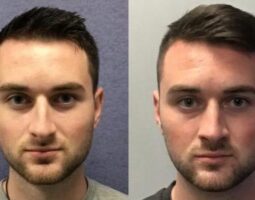 Affordable Plastic Surgery