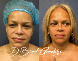 Dr. Brad Gandolfi MD