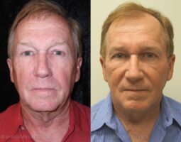 Dr. Brad Gandolfi MD