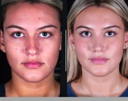 Saman Facial Plastic Surgery