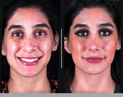 Saman Facial Plastic Surgery