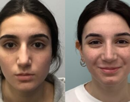 Affordable Plastic Surgery