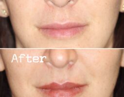 Dara Liotta, MD, FACS