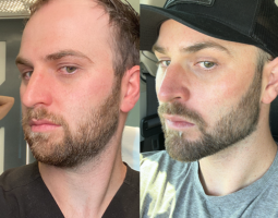 Jason Emer MD