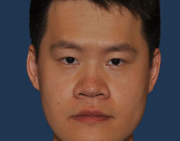 Jerry W. Chang, MD, FACS