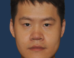 Jerry W. Chang, MD, FACS