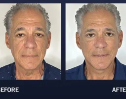 Robert Chouake, MD