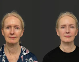 Dr. Lesley Rabach